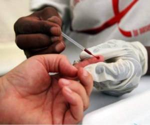 Las personas pueden ir a los centros de salud a realizarse la prueba de VIH/sida.