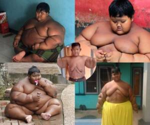 Así es Arya Permana, el niño de 12 años que logró perder más de 100 kilos. Fotos: cortesía.
