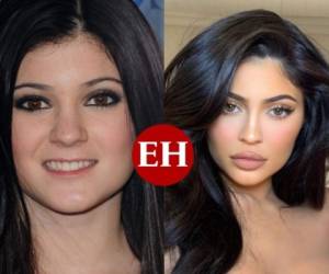 A la izquierda, Kylie Jenner antes de sus procedimientos estéticos, a la derecha, como luce actualmente. Fotos: Instagram