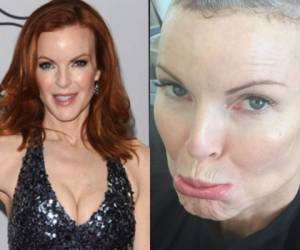 Marcia Cross se hizo famosa por su papel de Bree en la serie estadounidense Desperate Housewives.