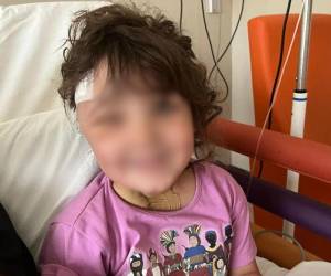 El caso involucra a Sara, una niña de cuatro años, quien llegó al hospital con una aguja alojada en el interior de su mejilla, una situación originada durante una visita al dentista para tratar unas caries.