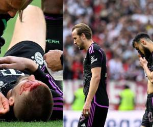 Guerreiro se lesiona y será “probablemente” baja ante el Real Madrid.