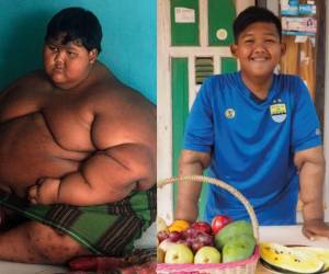 Arya Permana era considerado el niño más gordo del mundo. Cuando tenía 9 años pesaba 190 kilos (418 libras). A continuación te mostramos su impresionante cambio físico.