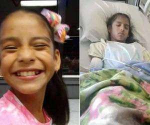 Rosa Hernández sufre de parálisis cerebral, una enfermedad de desarrollo del cerebro que afecta el movimiento del cuerpo y el control sobre los músculos.