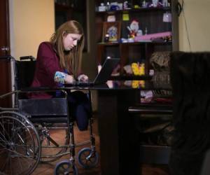 Shirley Meléndez a sus 25 años fue amputada de sus extremidades como últma solución a negligencia médica
