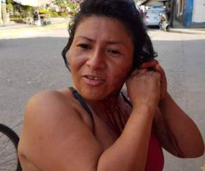 El caso de la mujer mantiene consternados a los pobladores ya se trata de la segunda persona que se arranca una parte del cuerpo. (Foto: AFP/ El Heraldo Honduras/ Noticias Honduras hoy)