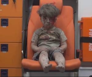 Omran Daqneesh sobrevivió a un ataque que se registró en la ciudad de Alepo, Siria.