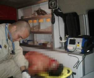 Los cautro heridos estaban trabajando en la caseta cuando explotó la pólvora (Foto: Bomberos de Honduras/ El Heraldo Honduras/ Noticias de Honduras)