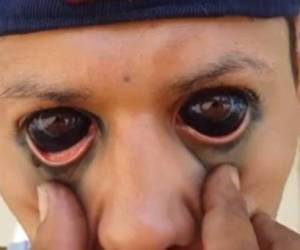 El pasado 18 de abril de este año, se reveló un video donde Braulio Bustillo, se tatuó sus ojos con un procedimiento conocido como tatuaje ocular o eyeball tattoo.