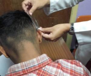 El HEU aplicó el jueves el tratamiento de crecimiento a personas que tienen agujeros en el pelo.