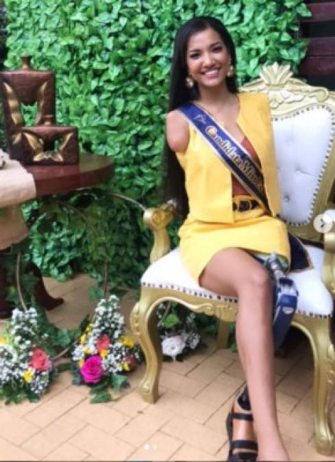 Victoria Salcedo, modelo sin brazos ni pierna que compite en Miss Ecuador