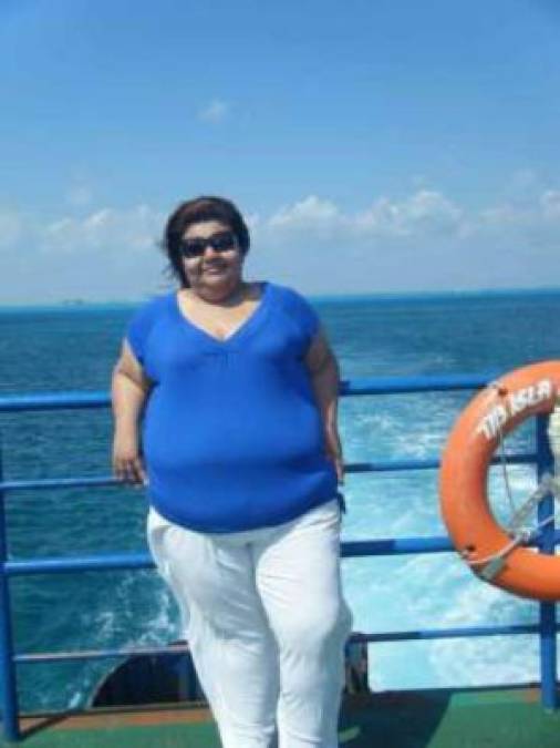 Fotos: Jazmín Islas y sus 86 kilos menos