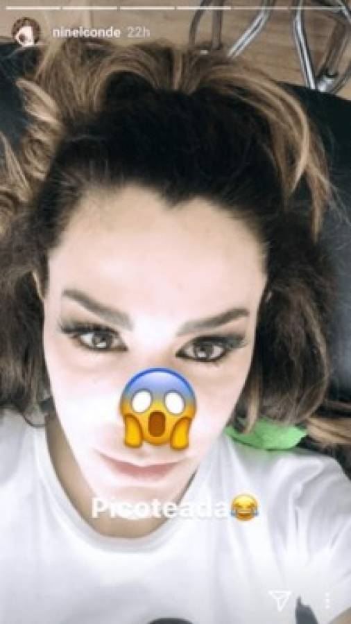 Esta fue una de las fotos que publicó durante su tratamiento facial. Foto captura Instagram