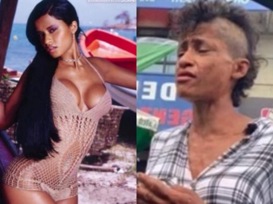 Antes y después de Suzy Pérez, modelo 'consumida' por las drogas