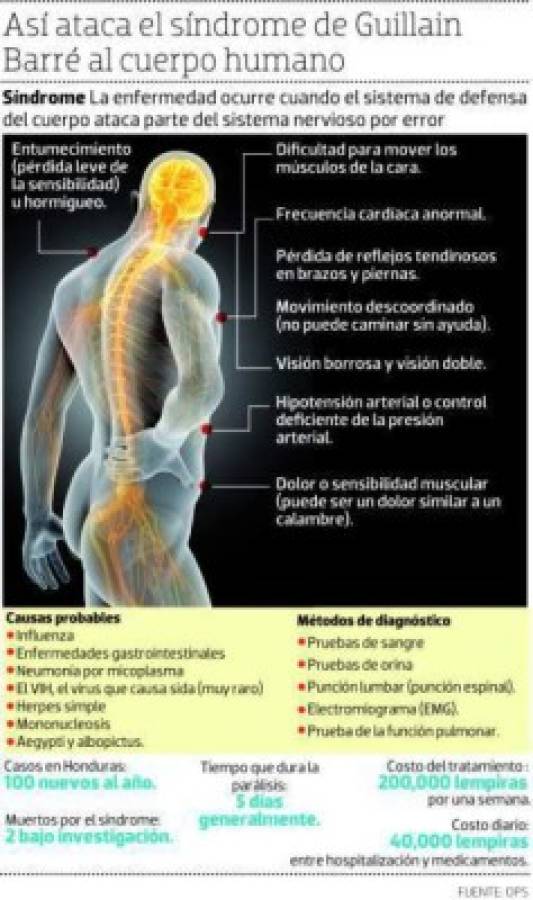 Honduras: Secretaría de Salud confirma la primera muerte a causa del Guillain-Barré