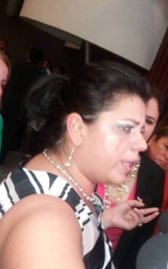 Diputada denuncia agresión de la esposa de David Romero