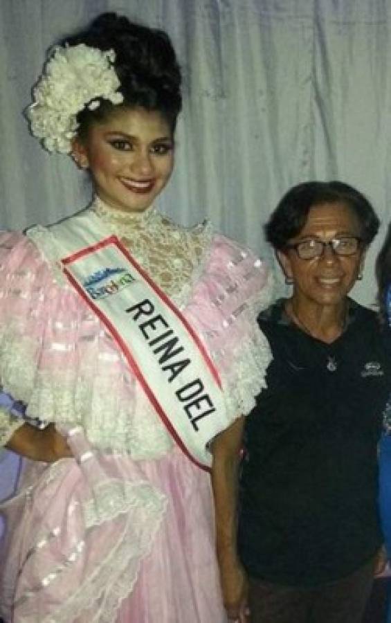 Los 'retoques' en el rostro de Sthefany Gutiérrez, Miss Venezuela, que revolucionan Internet