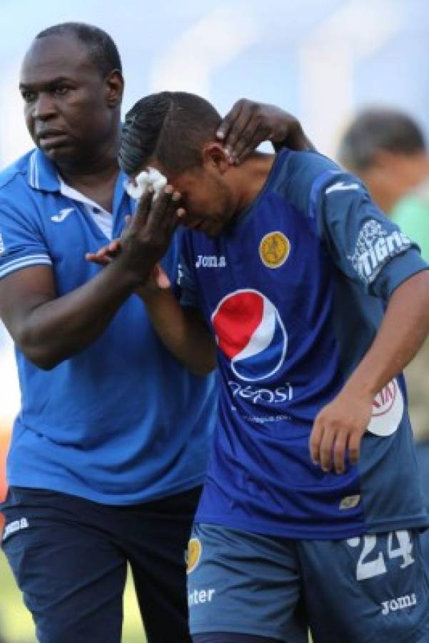 El Motagua se apunta en la cima