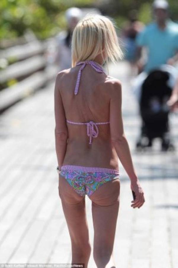 Famosa actriz de Hollywood es víctima de la anorexia