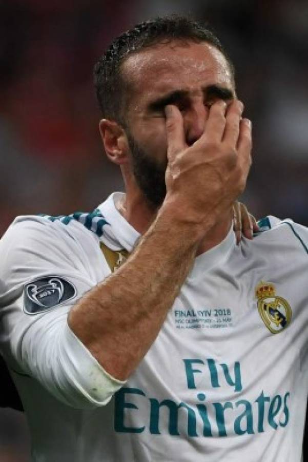 El defensa del Real Madrid, Dani Carvajal, llora al sufrir lesión en Champions. Foto AFP