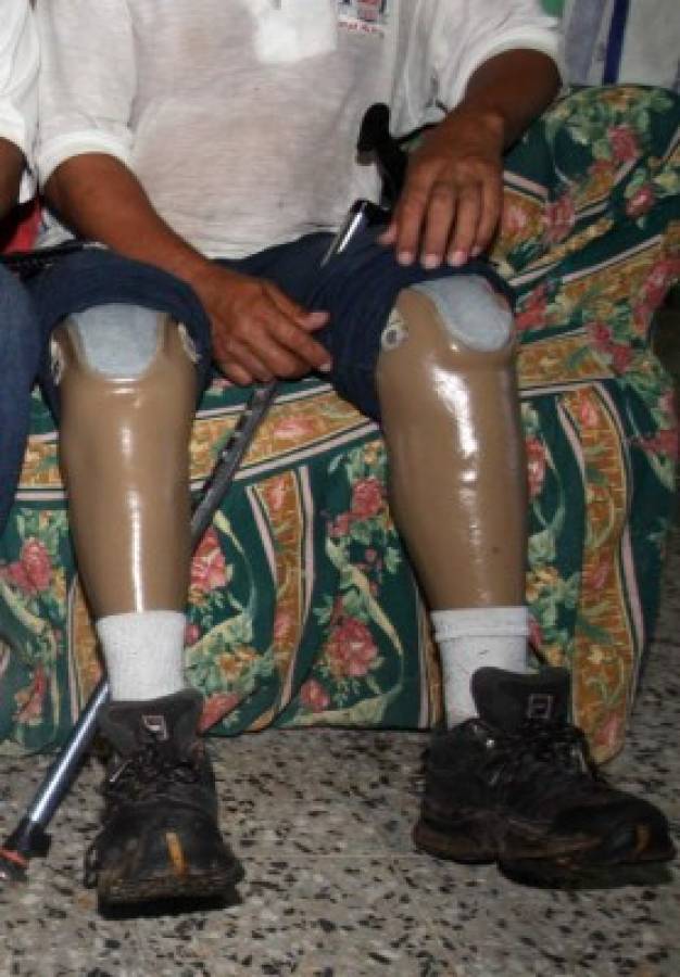 Unos 400 hondureños mutilados por 'La bestia”