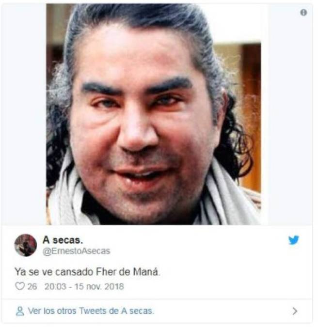 El nuevo rostro de Fher de Maná desata memes en las redes sociales