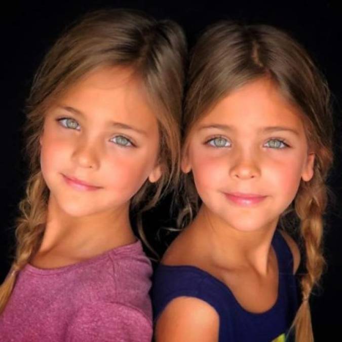 FOTOS: Leah Rose y Ava Marie, las gemelas más bellas del mundo, son sensación en Instagram