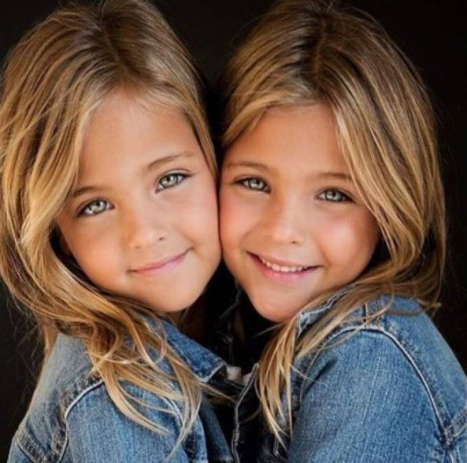 FOTOS: Leah Rose y Ava Marie, las gemelas más bellas del mundo, son sensación en Instagram