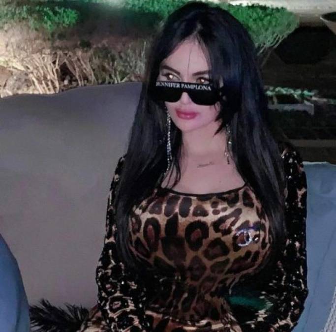 Influencer se realiza cientos de cirugías para parecerse a Kim Kardashian y ahora se arrepiente