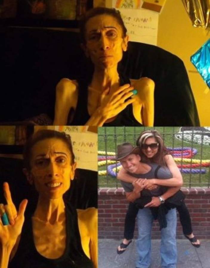 Así luce hoy Rachael Farrokh la mujer que pidió ayuda para superar su anorexia