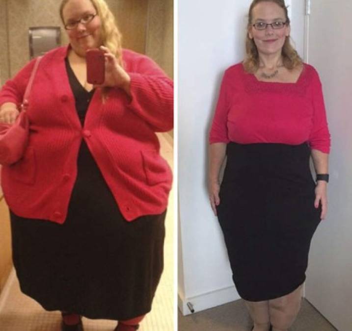 Fotos inspiradoras del antes y después de obesos que bajaron de peso