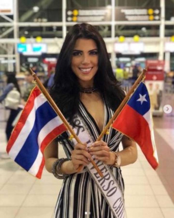 Andrea Díaz, Miss Chile, fue quemada con ácido durante tratamiento de belleza