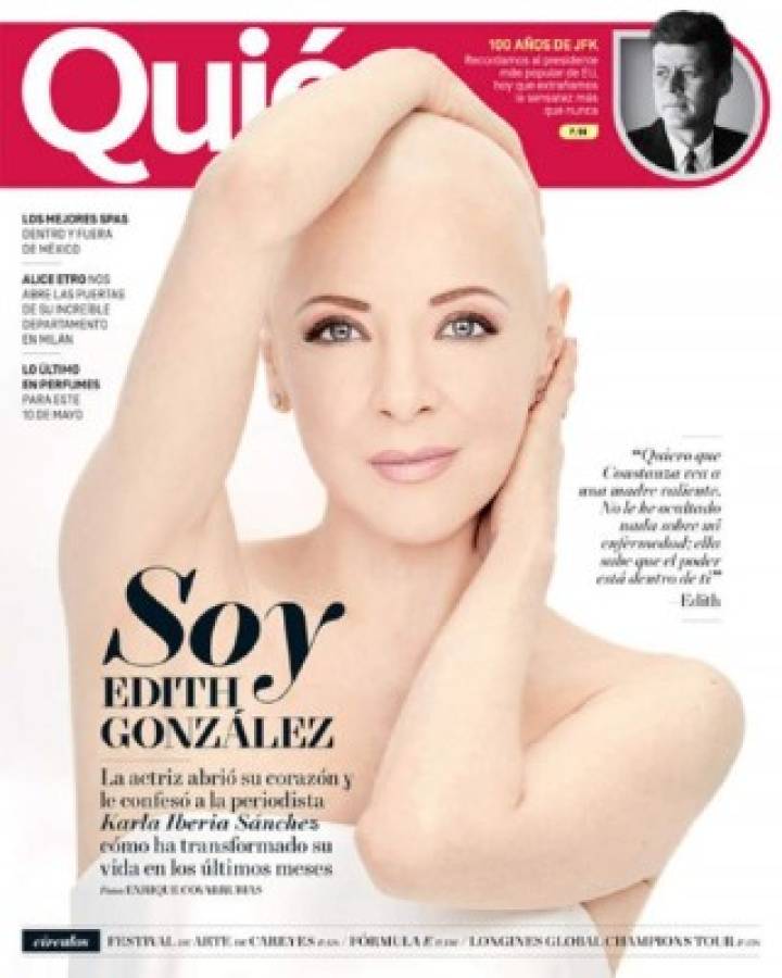 Edith Gonzáles optimista ante el cáncer