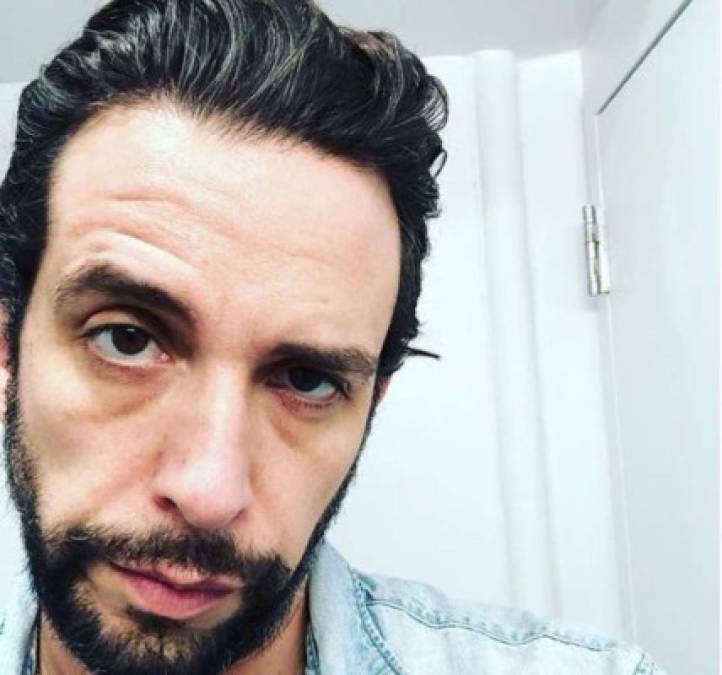 Drama del actor Nick Cordero al perder una pierna por el coronavirus