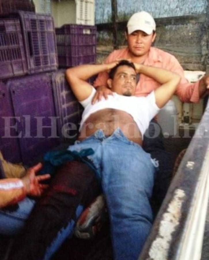 Uno de los obreros recibió un balazo en la rodilla durante la refriega entre trabajadores militares (Foto: El Heraldo Honduras/ Noticias de Honduras)