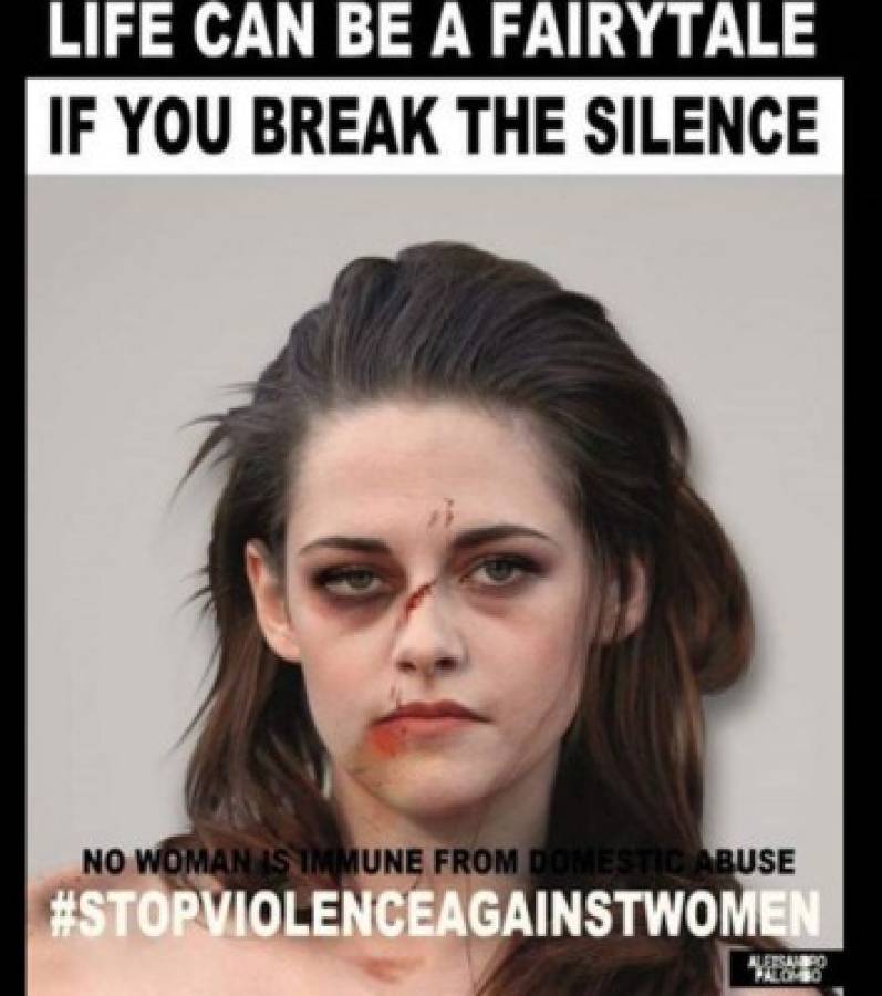 Campaña muestra fotos de celebridades como si fueran víctimas de violencia doméstica