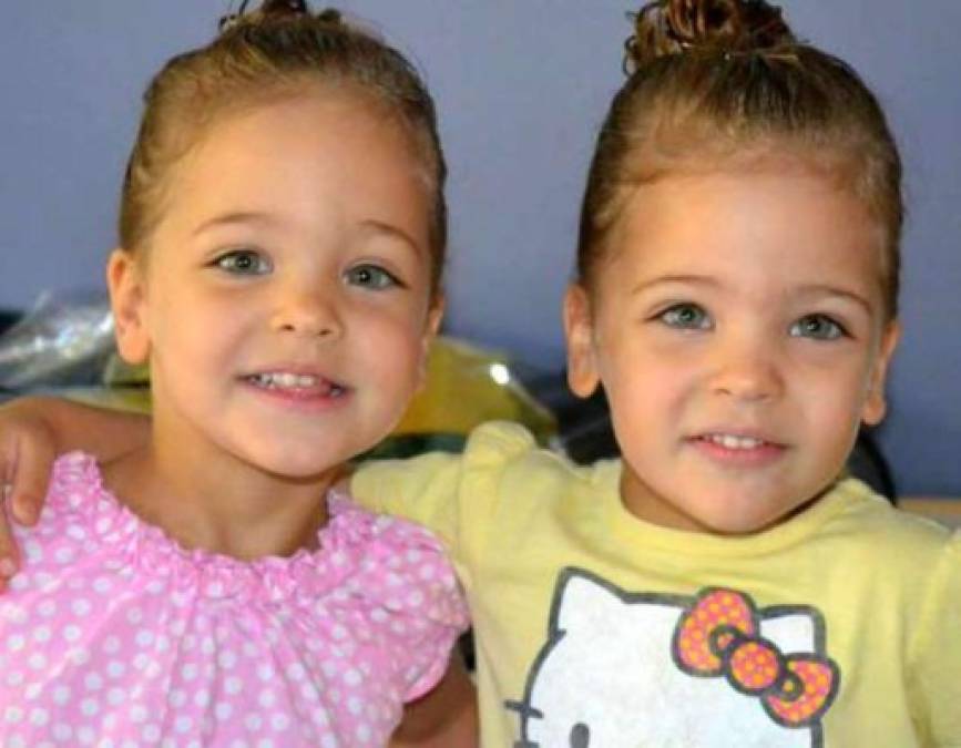 FOTOS: Los datos que debes saber sobre las gemelas más bellas del mundo