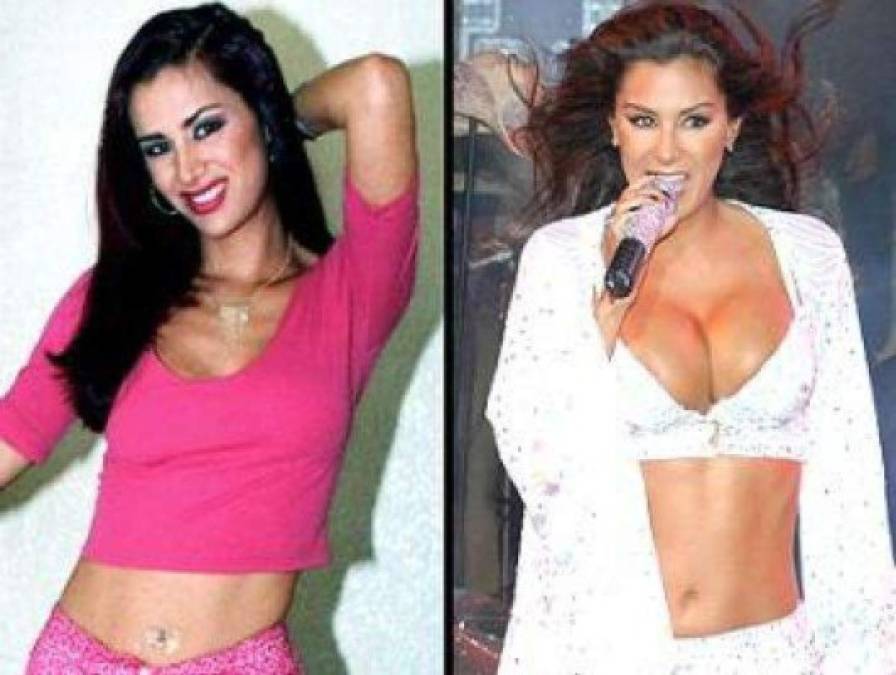 Antes y después: así lucen varias famosas mexicanas después de las cirugías