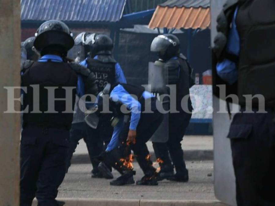 Fotos: Así terminaron quemados cuatro policías tras violento enfrentamiento con miembros del MEU