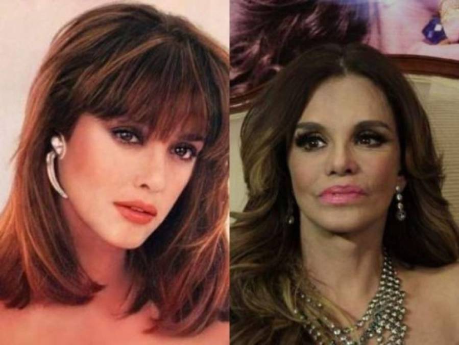 FOTOS: Antes y después de famosos que se operaron la nariz
