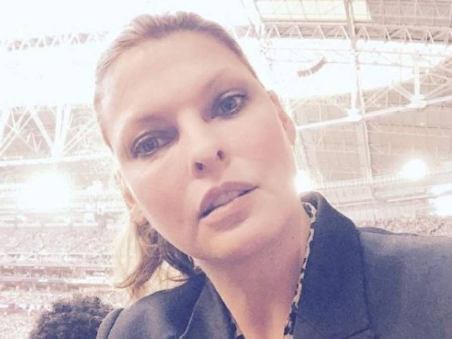 'Quedé permanentemente deformada': exmodelo Linda Evangelista rompe el silencio tras procedimiento estético