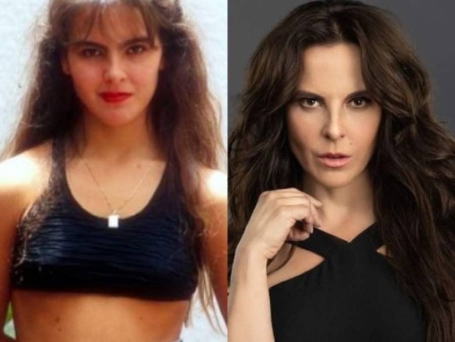 FOTOS: El antes y el después de la actriz mexicana Kate del Castillo