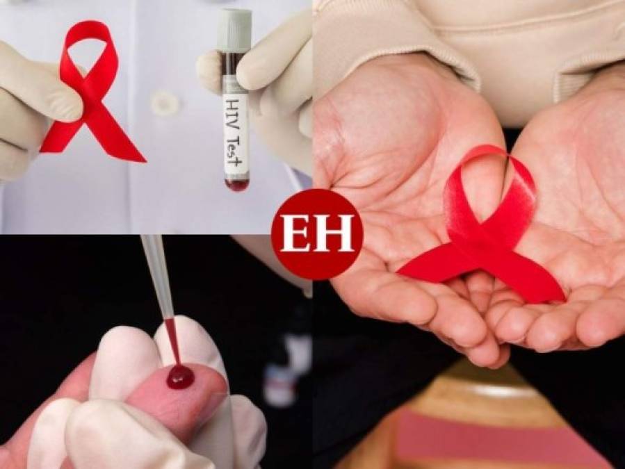 Estudios, una vacuna y una lucha infinita: datos sobre el VIH/Sida
