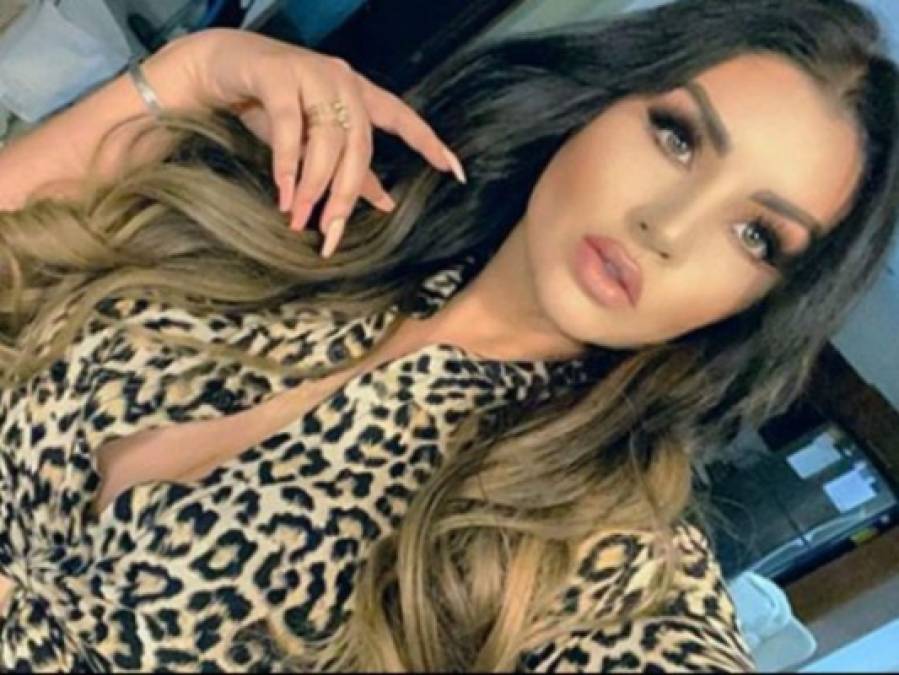 Las cirugías de Mariana González, la Kim Kardashian mexicana (FOTOS)