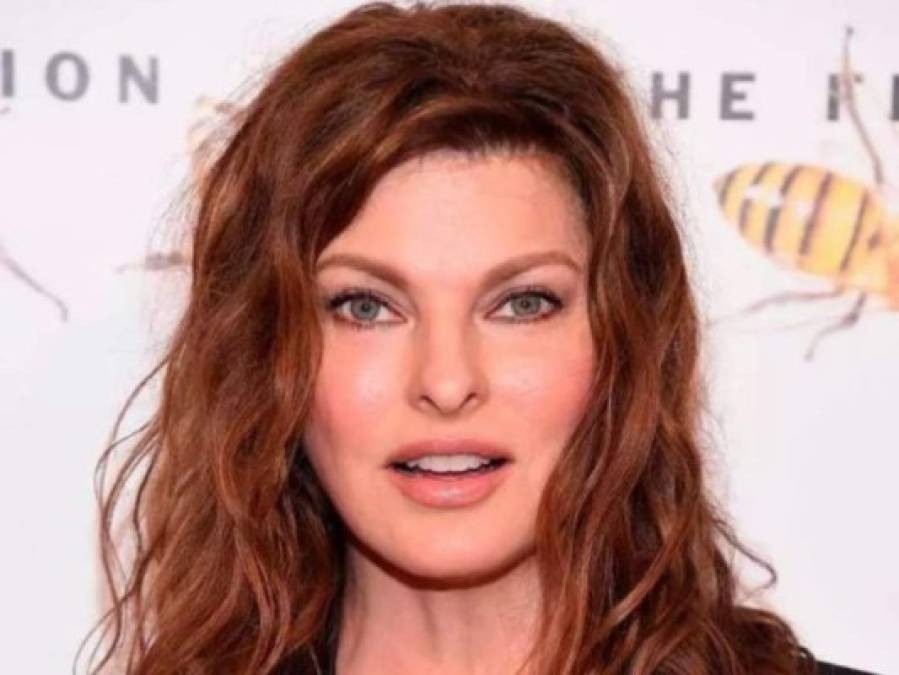 'Quedé permanentemente deformada': exmodelo Linda Evangelista rompe el silencio tras procedimiento estético