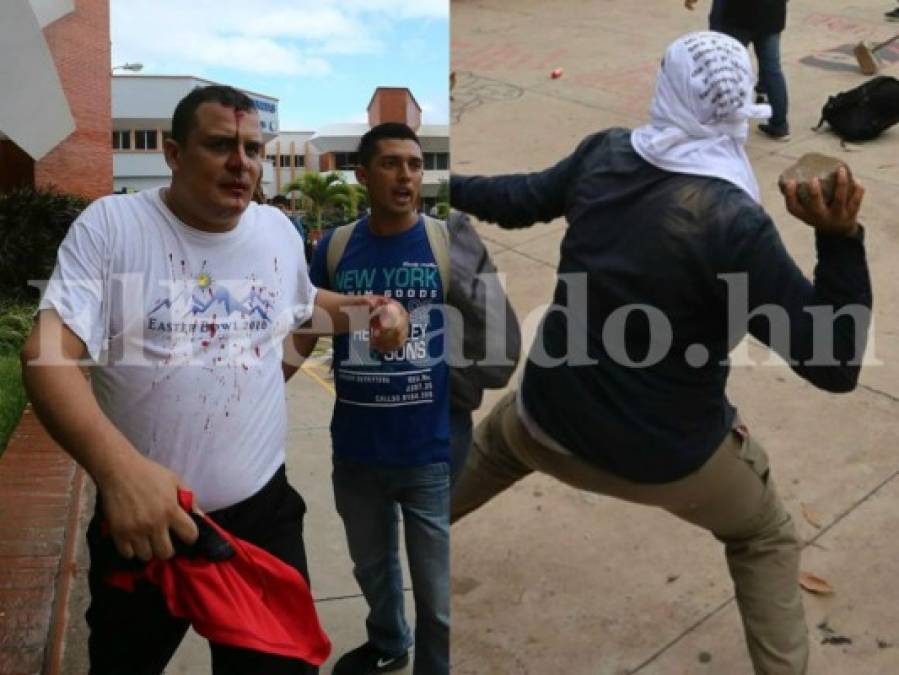 Las diez fotos más impactantes de la batalla entre universitarios y seguridad privada en la UNAH