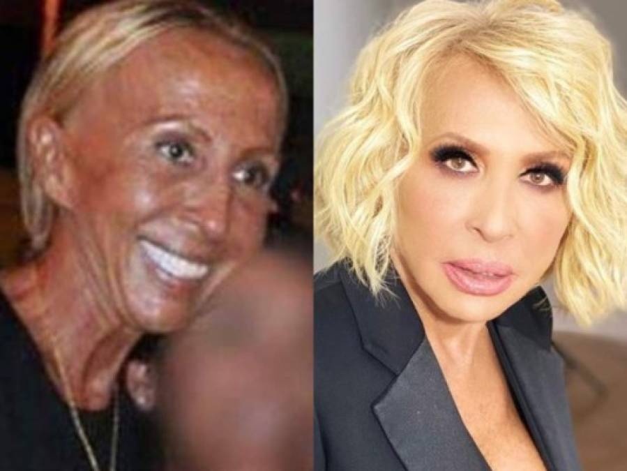 FOTOS: El cambio de Laura Bozzo tras destruir su cara con bótox