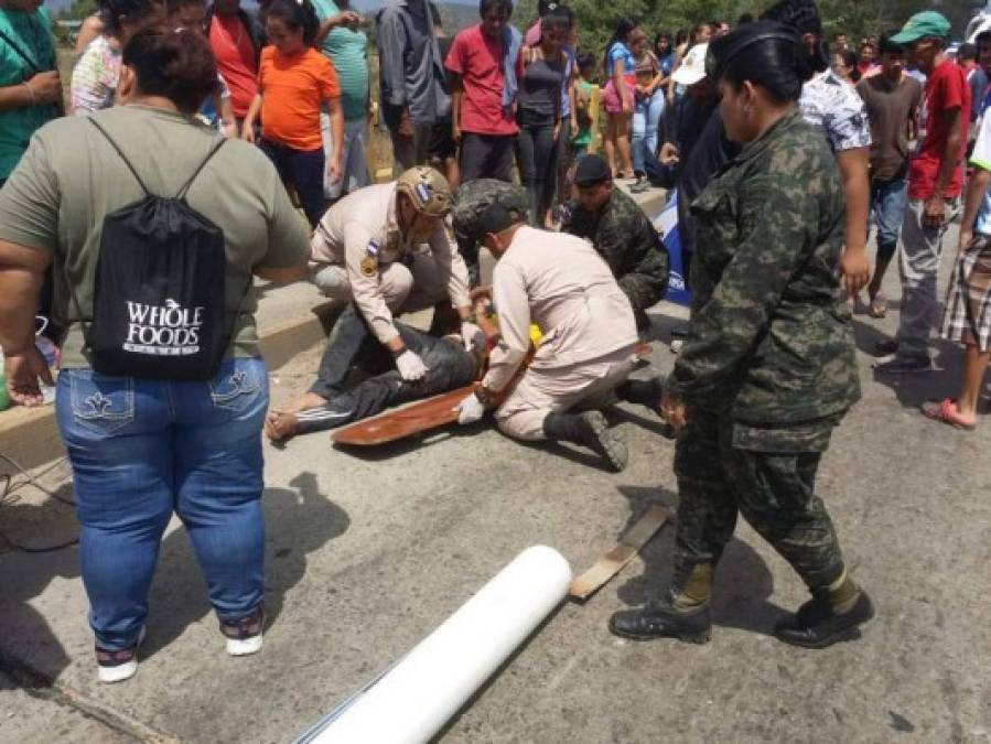 Fotos: Los destrozos que dejó el aparatoso accidente en carretera a La Lima