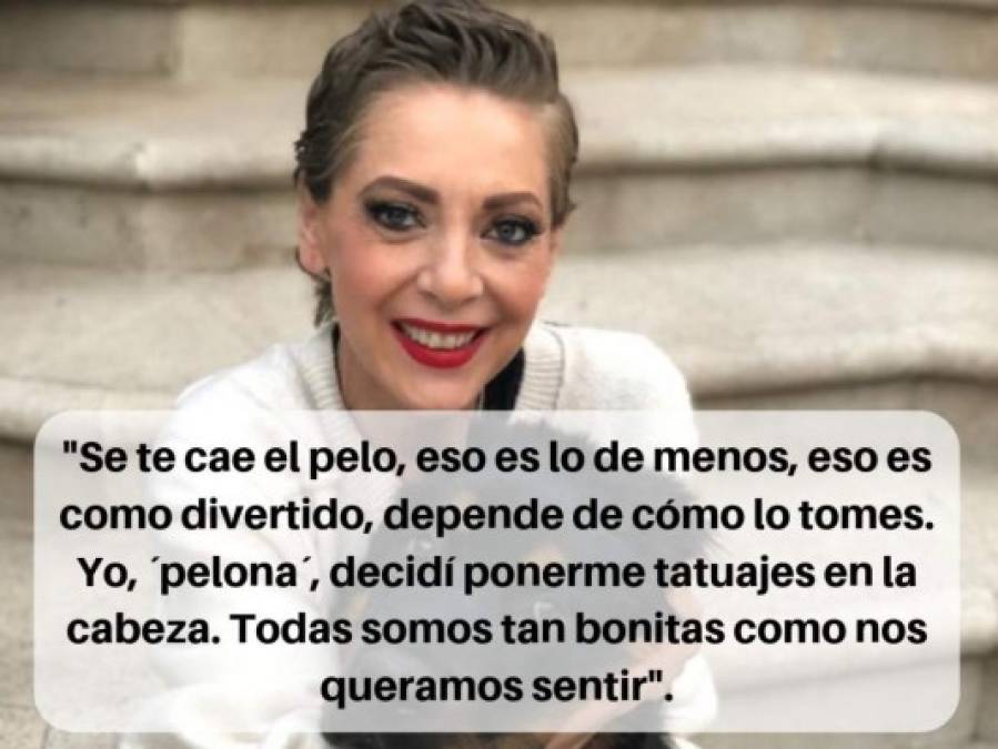 Edith González y sus poderosas frases durante su batalla contra el cáncer