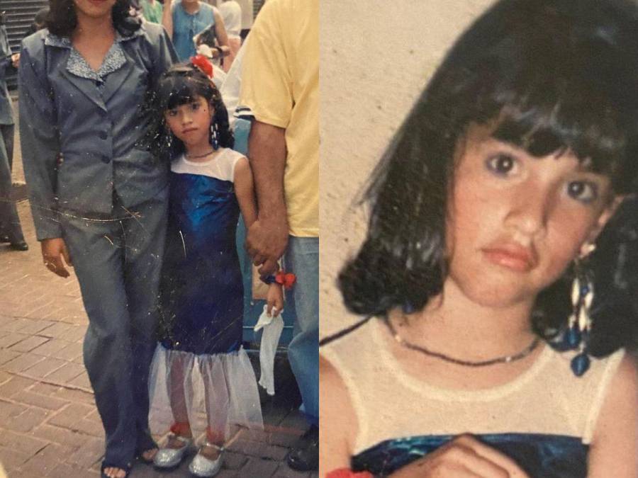 El antes y después de Carolina Lanza: la historia detrás de su sorprendente cambio físico